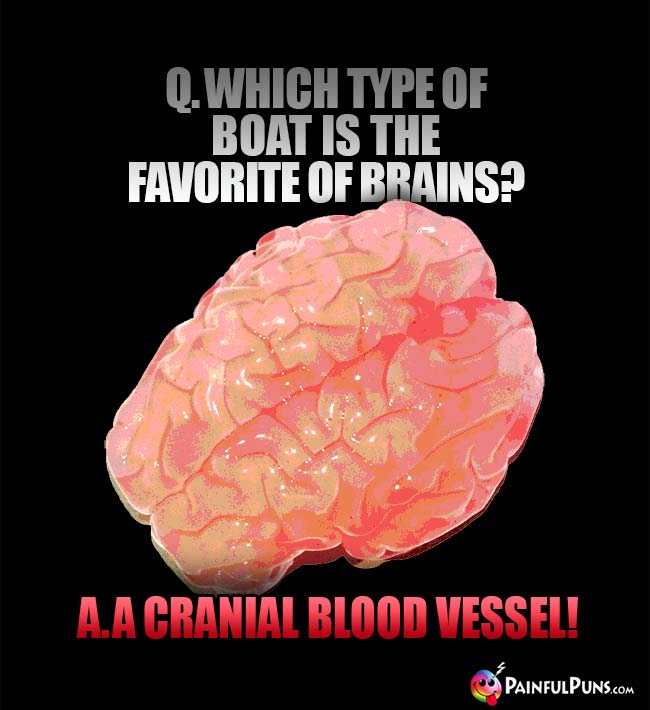 Q. Which type of boat is the favorite of brains? A. A cranial blood vessel!
