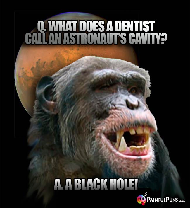 Q. What does a dentist call an astronaut's cavity? A. A black hole!