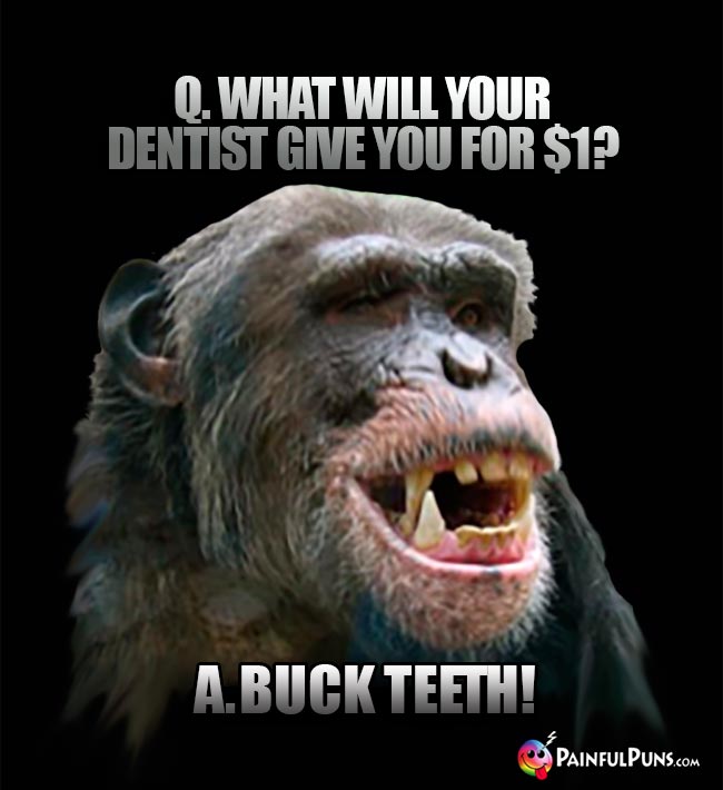 Q. What will your dentist give you for $1? A. Buck teeth!