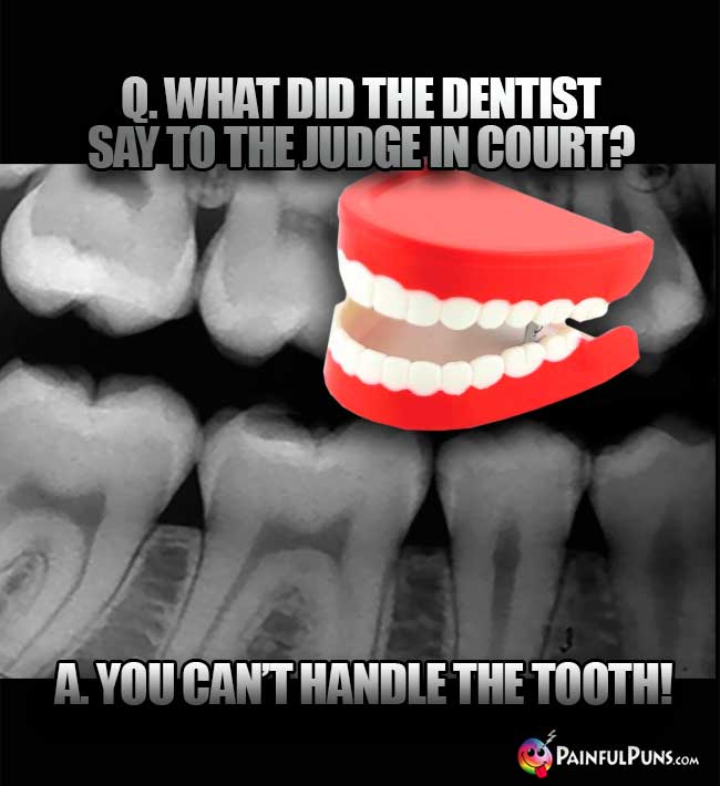 Q. What did the dentist say to the judge in court? A. You can't handle the tooth!
