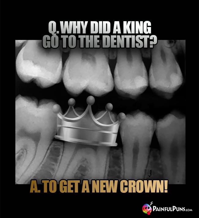 Q. Why did a king go to the dentist? A. To get a new crown!