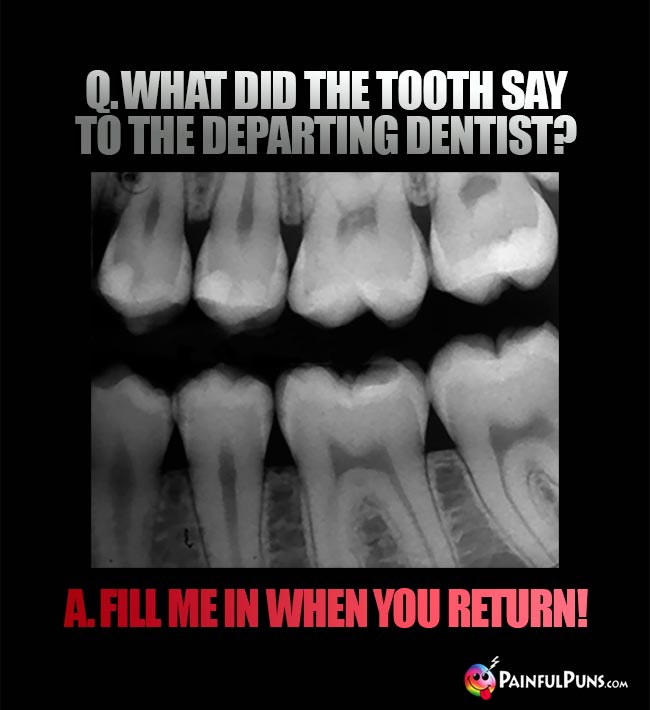 Q. What did the tooth say to the departing dentist? A Fill me in when you return!