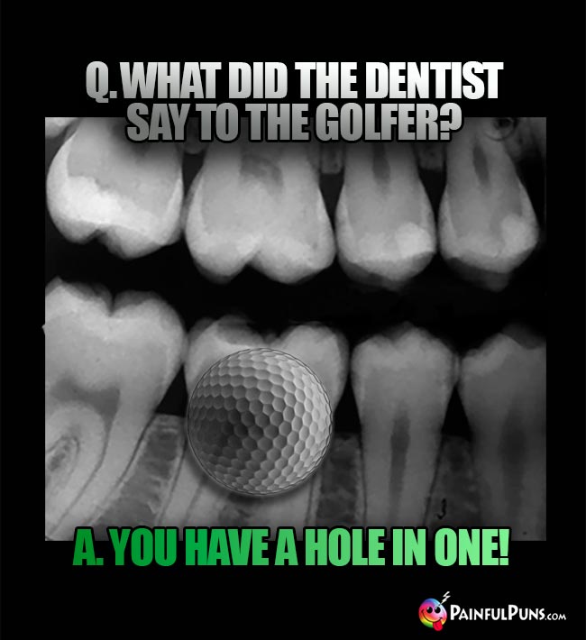 Q. What did the dentist say to the golfer? A. You have a hole in one!