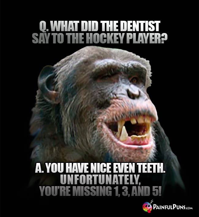 Q. What did the dentist say to the hockey player? A. You have nice even teet. Unfortunately, you're missing 1, 3, and 5!