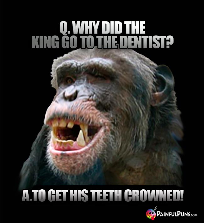 Q. Why did the king go to the dentist? A. To get his teeth crowned!