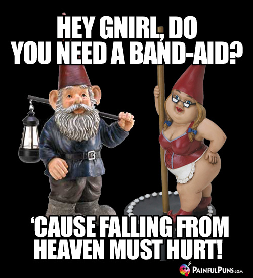 Hey Gnirl, do you need a Band-aid? 'Cause falling from heaven must hurt!