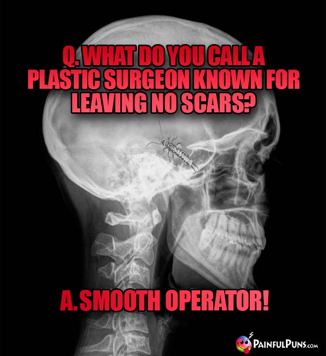 Q. What do you call a plastic surgeon knnown for leaving no scars A. Smooth operator!