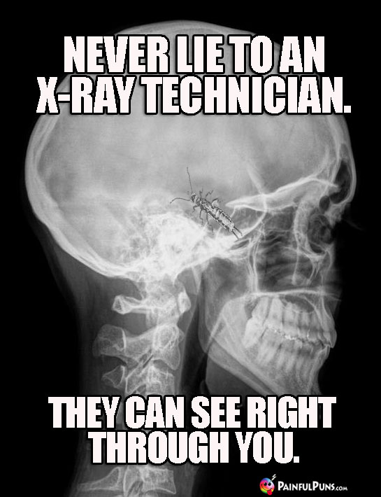Never lie to an X-ray technician. They can see right through you.